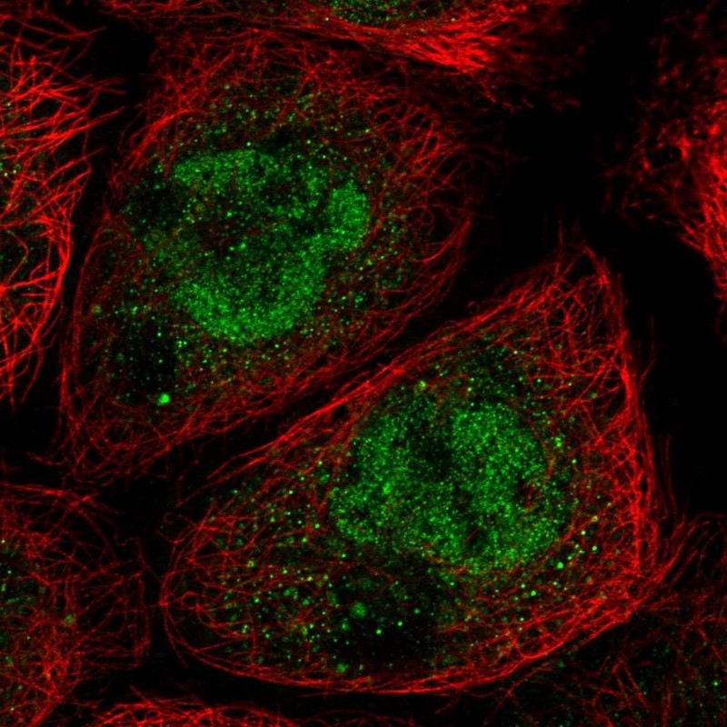 Immunocytochemistry/Immunofluorescence: FLJ37543 Antibody [NBP2-14418] - Staining of human cell line A-431 shows positivity in nucleus but not nucleoli.