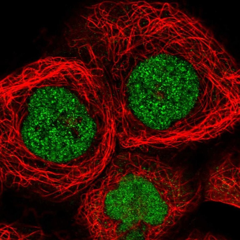 Immunocytochemistry/Immunofluorescence: PSORS1C1 Antibody [NBP2-14544] - Staining of human cell line A-431 shows positivity in nucleus.