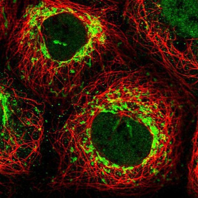 Immunocytochemistry/Immunofluorescence: PAF1 Antibody [NBP2-13724] Staining of human cell line A-431 shows positivity in nucleus but not nucleoli and mitochondria.