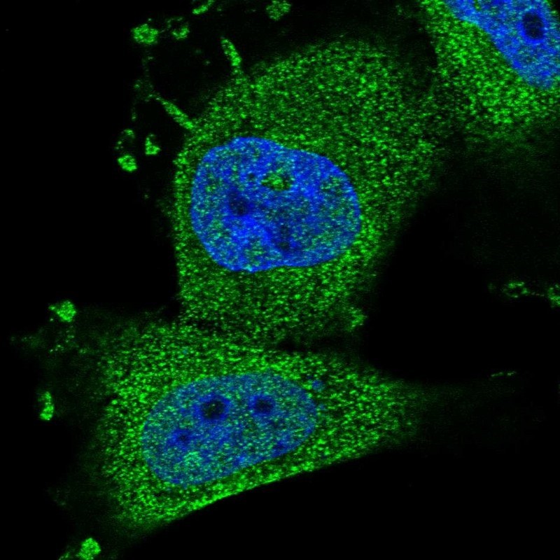 Immunocytochemistry/Immunofluorescence: PLA2G4E Antibody [NBP2-13767] - Staining of human cell line U-251 MG shows positivity in cytoplasm.