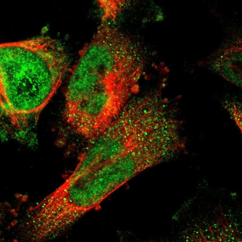 Immunocytochemistry/Immunofluorescence: CCDC141 Antibody [NBP1-91224] - Staining of human cell line U-251MG shows positivity in nucleus but not nucleoli & cytoplasm.