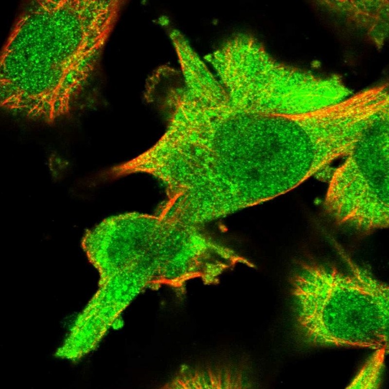 Immunocytochemistry/Immunofluorescence: ARHGAP27 Antibody [NBP1-91223] - Staining of human cell line U-251MG shows positivity in cytoplasm.