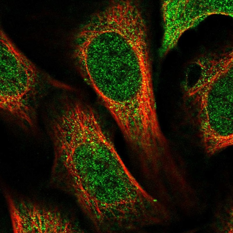 Immunocytochemistry/Immunofluorescence: LAS2 Antibody [NBP1-91720] - Staining of human cell line U-2 OS shows positivity in nucleus but not nucleoli & cytoplasm.