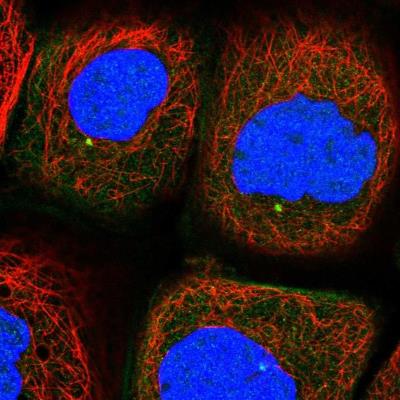 Immunocytochemistry/Immunofluorescence: BCMO1 Antibody [NBP1-91698] - Staining of human cell line A-431 shows positivity in centrosome.
