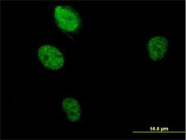 Immunocytochemistry/Immunofluorescence: RBM5 Antibody [H00010181-B01] - RBM5 ( Cat# H00010181-B01 ) on HeLa cell . [antibody concentration 10 ug/ml]