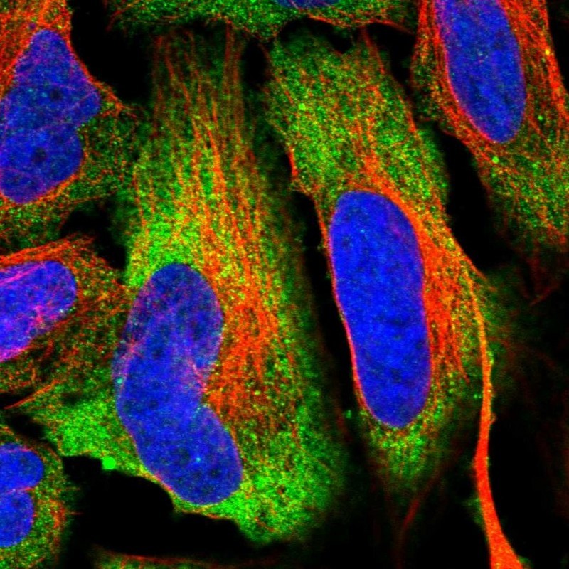 Immunocytochemistry/Immunofluorescence: GAB4 Antibody [NBP1-91918] - Staining of human cell line U-2 OS shows positivity in cytoplasm.