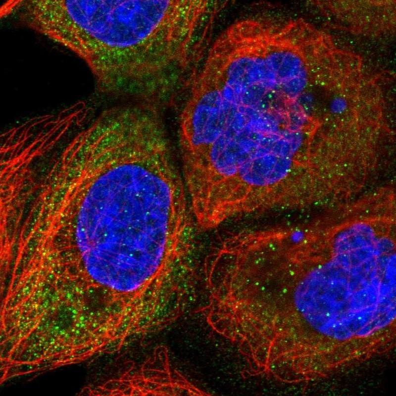 Immunocytochemistry/Immunofluorescence: Collagen XXV Antibody [NBP1-91033] - Staining of human cell line A-431 shows positivity in cytoplasm.