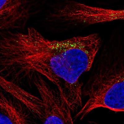 Immunocytochemistry/Immunofluorescence: DPY19L4 Antibody [NBP1-91057] - Staining of human cell line U-2 OS shows positivity in vesicles.