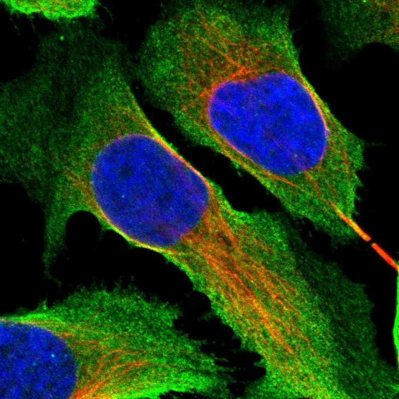 Immunocytochemistry/Immunofluorescence: C9orf117 Antibody [NBP1-90934] - Staining of human cell line U-2 OS shows positivity in plasma membrane & cytoplasm.