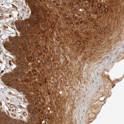 Immunohistochemistry-Paraffin: C9orf117 Antibody [NBP1-90934] - Staining of human oral mucosa shows strong cytoplasmic positivity in squamous epithelial cells.