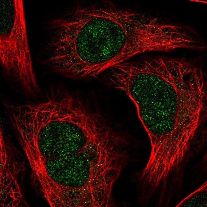 Immunocytochemistry/Immunofluorescence: PRDM6 Antibody [NBP1-91022] - Staining of human cell line U-2 OS shows positivity in nucleus but not nucleoli.