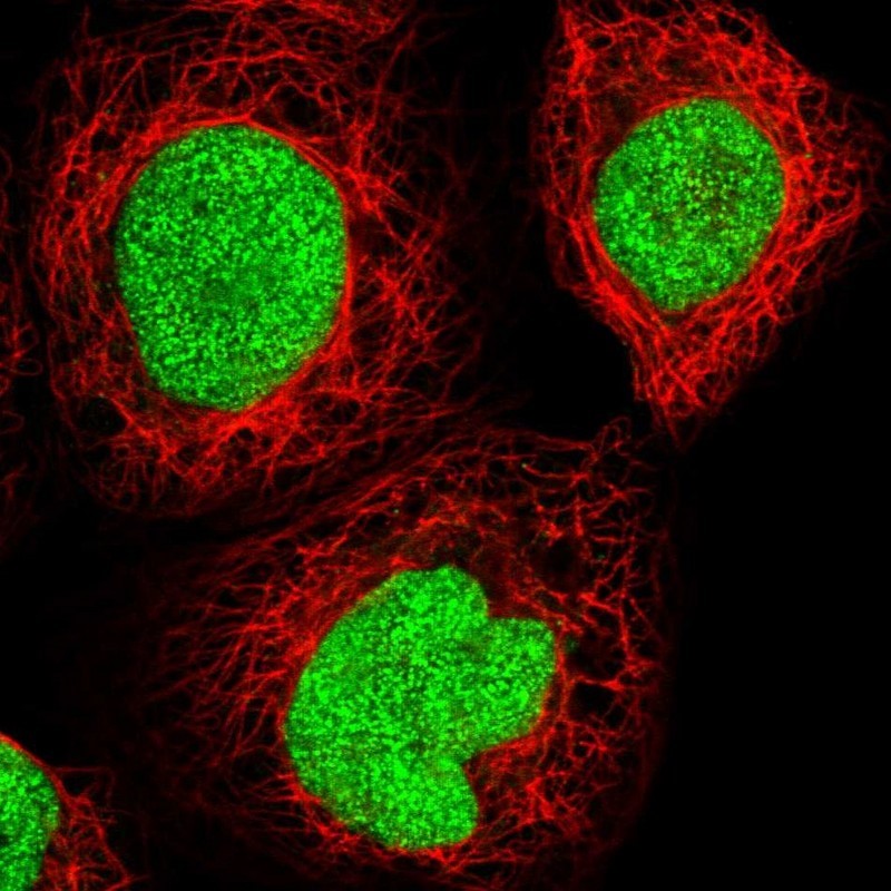Immunocytochemistry/Immunofluorescence: MCART6 Antibody [NBP1-91007] - Staining of human cell line A-431 shows positivity in nucleus.