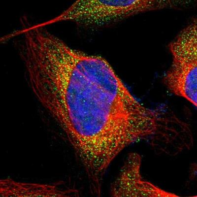 Immunocytochemistry/Immunofluorescence: A4GNT Antibody [NBP1-89129] - Staining of human cell line U-2 OS shows positivity in vesicles.