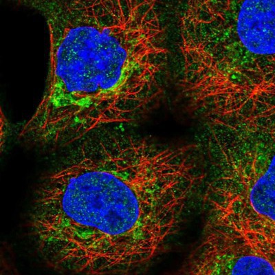 Immunocytochemistry/Immunofluorescence: SLC25A24 Antibody [NBP1-89049] Staining of human cell line A-431 shows positivity in cytoplasm & mitochondria.