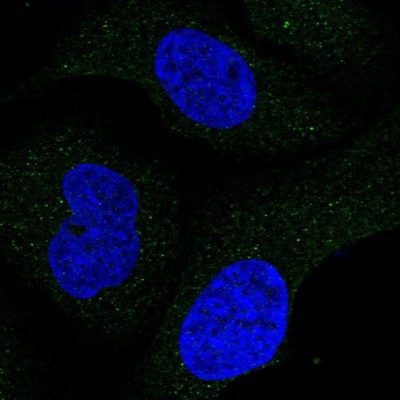Immunocytochemistry/Immunofluorescence: DAB2IP Antibody [NBP1-89219] Staining of human cell line U-2 OS shows positivity in cytoplasm.