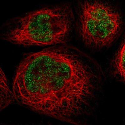 Immunocytochemistry/Immunofluorescence: AHRR Antibody [NBP1-89194] - Staining of human cell line A-431 shows positivity in nucleus but not nucleoli.