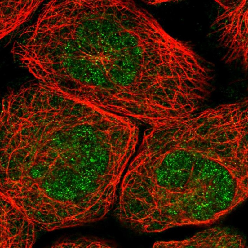 Immunocytochemistry/Immunofluorescence: ALLC Antibody [NBP1-89155] - Staining of human cell line A-431 shows positivity in nucleus but not nucleoli & cytoplasm.