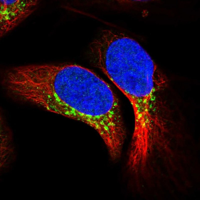 Immunocytochemistry/Immunofluorescence: KIAA1704 Antibody [NBP1-89252] - Staining of human cell line U-2 OS shows positivity in golgi apparatus.