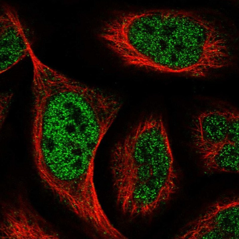 Immunocytochemistry/Immunofluorescence: ADAMTS6 Antibody [NBP1-89245] - Staining of human cell line U-2 OS shows positivity in nucleus but not nucleoli.