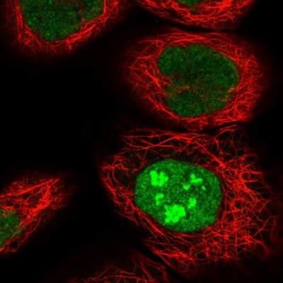 Immunocytochemistry/Immunofluorescence: FBXW10 Antibody [NBP1-88459] - Staining of human cell line A-431 shows positivity in nucleus & nucleoli.