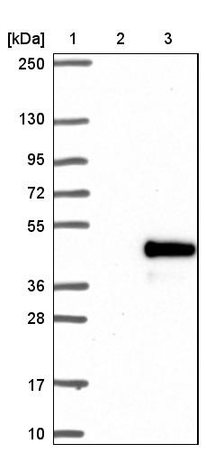 Western Blot: CORD2 Antibody [NBP1-88060] - Lane 1: Marker [kDa] 250, 130, 95, 72, 55, 36, 28, 17, 10<br/>Lane 2: Negative control (vector only transfected HEK293T lysate)<br/>Lane 3: Over-expression lysate (Co-expressed with a C-terminal myc-DDK tag (~3.1 kDa) in mammalian HEK293T cells, LY424645)