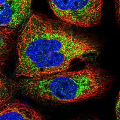 Immunocytochemistry/Immunofluorescence: Klkbl4 Antibody [NBP1-88044] Staining of human cell line A-431 shows positivity in cytoplasm.