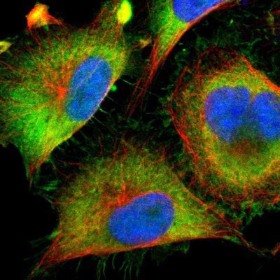 Immunocytochemistry/Immunofluorescence: BRPF1 Antibody [NBP1-88369] Staining of human cell line U-251MG shows positivity in plasma membrane & cytoplasm.