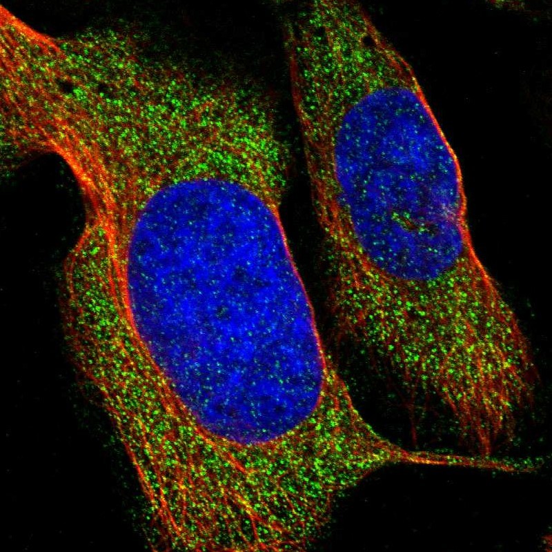 Immunocytochemistry/Immunofluorescence: LMF1 Antibody [NBP1-88442] - Staining of human cell line U-2 OS shows positivity in cytoplasm.