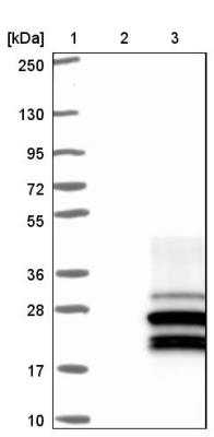 Western Blot: C14orf180 Antibody [NBP1-88427] - Lane 1: Marker [kDa] 250, 130, 95, 72, 55, 36, 28, 17, 10<br/>Lane 2: Negative control (vector only transfected HEK293T lysate)<br/>Lane 3: Over-expression lysate (Co-expressed with a C-terminal myc-DDK tag (~3.1 kDa) in mammalian HEK293T cells, LY423426)
