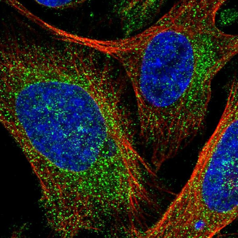 Immunocytochemistry/Immunofluorescence: LRRC3 Antibody [NBP1-88289] - Staining of human cell line U-2 OS shows positivity in cytoplasm.