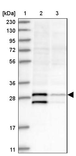 Western Blot: Thyrotropin Releasing Hormone Antibody [NBP1-87427] - Lane 1: Marker [kDa] 230, 130, 95, 72, 56, 36, 28, 17, 11<br/>Lane 2: Human cell line RT-4<br/>Lane 3: Human cell line U-251MG sp