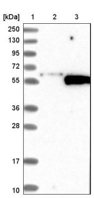 Western Blot: Synaptotagmin 5 Antibody [NBP1-87475] - Lane 1: Marker [kDa] 250, 130, 95, 72, 55, 36, 28, 17, 10<br/>Lane 2: Negative control (vector only transfected HEK293T lysate)<br/>Lane 3: Over-expression lysate (Co-expressed with a C-terminal myc-DDK tag (~3.1 kDa) in mammalian HEK293T cells, LY418847)