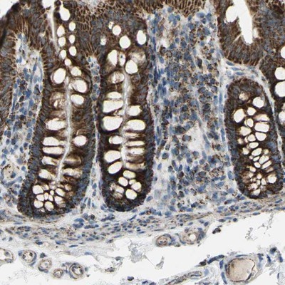 Immunohistochemistry-Paraffin: Synaptotagmin 5 Antibody [NBP1-87475] - Staining of human colon shows strong granular cytoplasmic positivity in glandular cells.