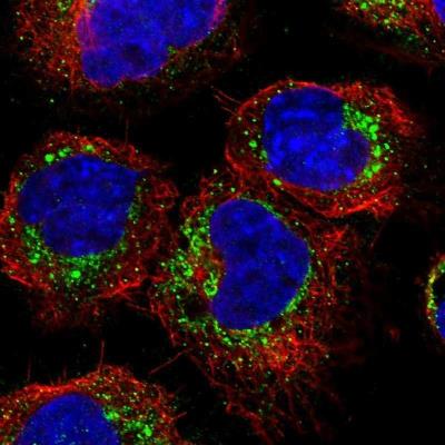 Immunocytochemistry/Immunofluorescence: Glypican 6 Antibody [NBP1-87565] - Glypican-6 Antibody [NBP1-87565] - Staining of human cell line A-431 shows positivity in golgi apparatus & vesicles.