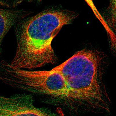 Immunocytochemistry/Immunofluorescence: Cytokeratin 2 Antibody [NBP1-87713] Staining of human cell line U-2 OS shows positivity in cytoplasm & cytoskeleton (intermediate filaments).