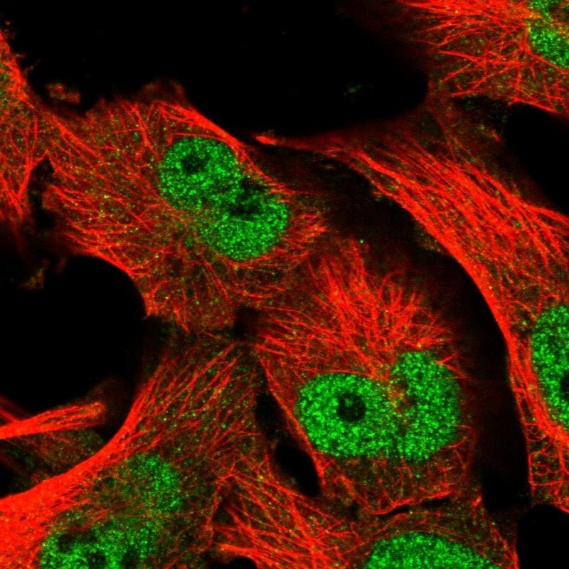 Immunocytochemistry/Immunofluorescence: ABC2 Antibody [NBP1-87918] - Staining of human cell line U-251MG shows positivity in nucleus but not nucleoli.