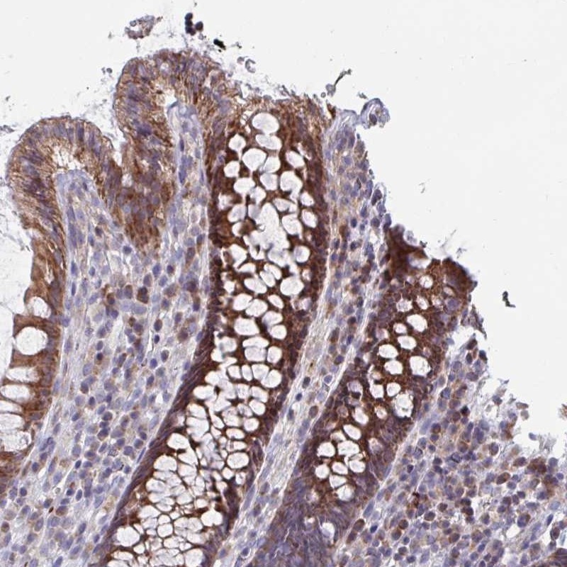 Immunohistochemistry: C2orf53 Antibody [NBP2-32417] - Immunohistochemical staining of human colon shows strong cytoplasmic positivity in glandular cells.