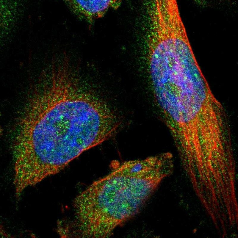 Immunocytochemistry/Immunofluorescence: ALS2CR3 Antibody [NBP1-90182] - Staining of human cell line U-251MG shows positivity in nucleus, nucleoli & cytoplasm.