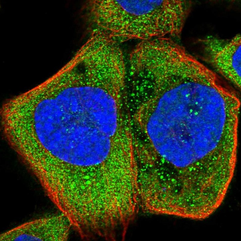 Immunocytochemistry/Immunofluorescence: C14orf105 Antibody [NBP1-90429] - Staining of human cell line A-431 shows positivity in cytoplasm.