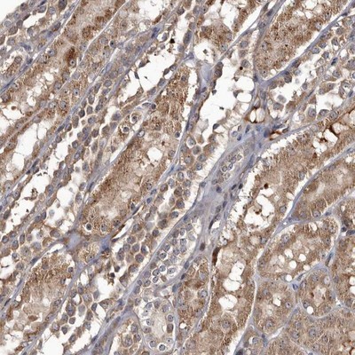 Immunohistochemistry-Paraffin: C14orf105 Antibody [NBP1-90429] - Staining of human kidney shows moderate cytoplasmic positivity and nucleolar staining in tubular cells.