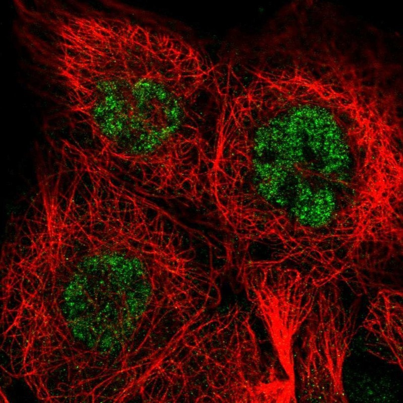 Immunocytochemistry/Immunofluorescence: PM20D2 Antibody [NBP2-33925] - Immunofluorescent staining of human cell line A-431 shows positivity in nucleus but not nucleoli.