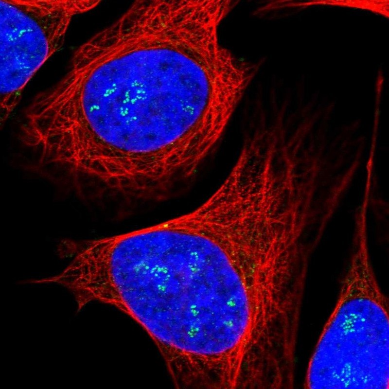 Immunocytochemistry/Immunofluorescence: DHRS7C Antibody [NBP1-90666] - Staining of human cell line U-2 OS shows positivity in nucleoli.