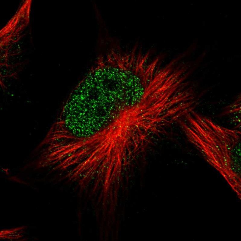 Immunocytochemistry/Immunofluorescence: ATG2B Antibody [NBP1-90732] - Staining of human cell line U-251MG shows positivity in nucleus but not nucleoli.