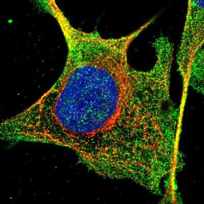 Immunocytochemistry/Immunofluorescence: FAM71D Antibody [NBP1-90724] Staining of human cell line U-2 OS shows positivity in nucleus but not nucleoli & cytoplasm.
