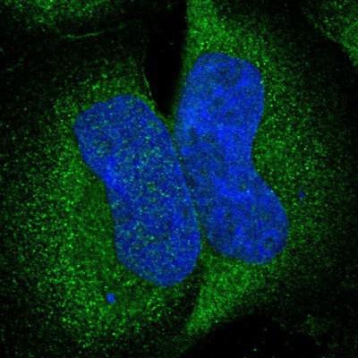 Immunocytochemistry/Immunofluorescence: FAM71D Antibody [NBP1-90723] - Staining of human cell line A-431 shows positivity in cytoplasm.