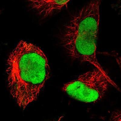 Immunocytochemistry/Immunofluorescence: RECQ1 Antibody [NBP1-87803] - Staining of human cell line U-251 MG shows positivity in nucleus but not nucleoli.