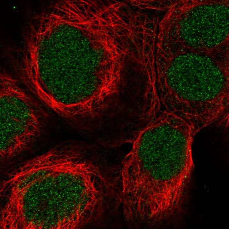 Immunocytochemistry/Immunofluorescence: SynGAP Antibody [NBP1-87841] - Staining of human cell line A-431 shows positivity in nucleus.