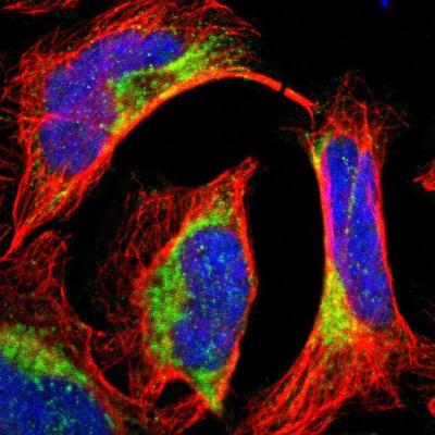 Immunocytochemistry/Immunofluorescence: KLHL31 Antibody [NBP1-88794] - Staining of human cell line U-2 OS shows positivity in mitochondria.