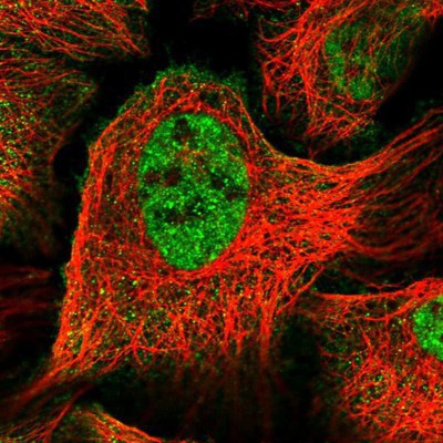 Immunocytochemistry/Immunofluorescence: UBR2 Antibody [NBP1-88759] Staining of human cell line U-2 OS shows positivity in nucleus but not nucleoli & plasma membrane.