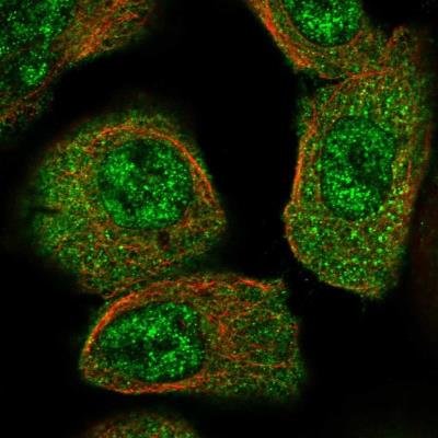 Immunocytochemistry/Immunofluorescence: Cancer Antigen 1 Antibody [NBP1-88734] - Staining of human cell line A-431 shows positivity in nucleus but not nucleoli & cytoplasm.